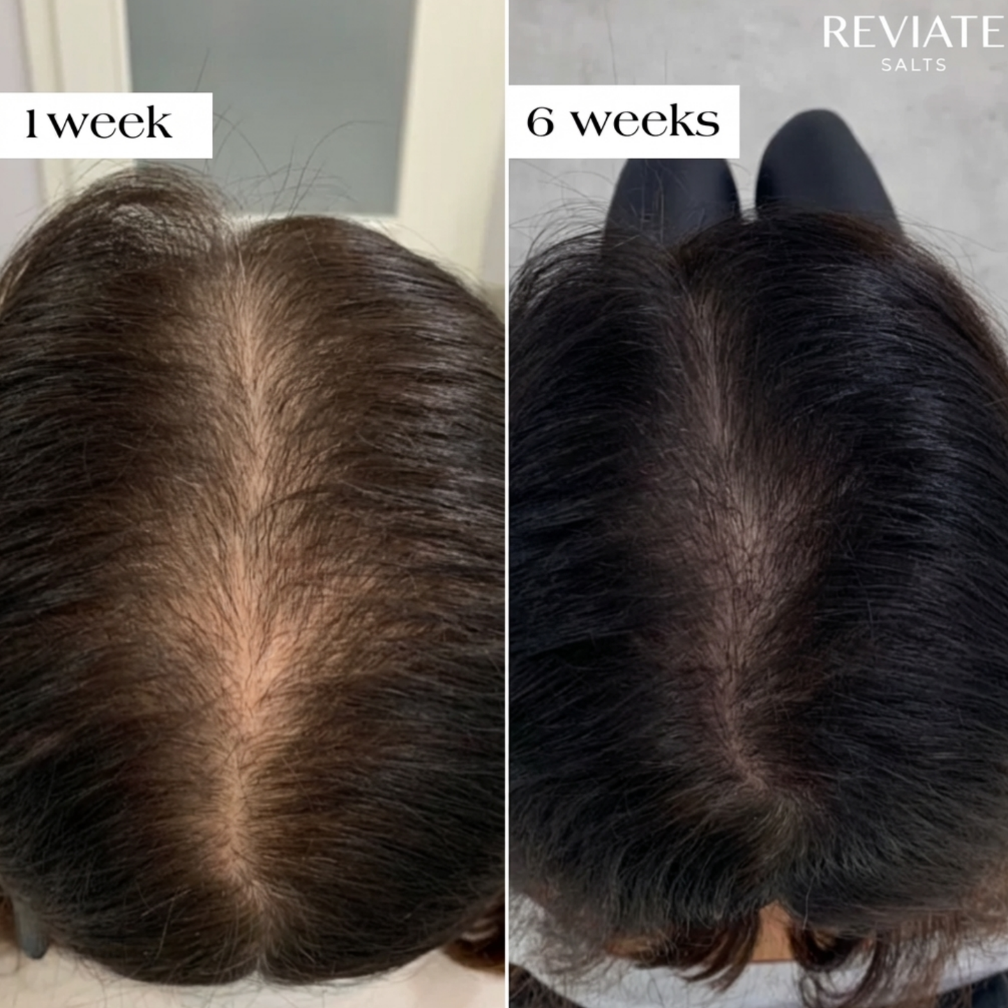 Reviate Salts Postpartum Hair Recovery Treatment