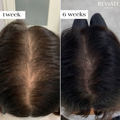Reviate Salts Postpartum Hair Recovery Treatment