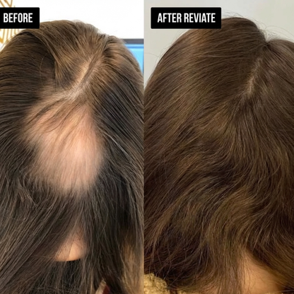 Reviate Salts Postpartum Hair Recovery Treatment